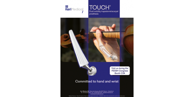 KeriMedical propose la prothèse Touch à double mobilité pour la traitement de la rhizarthrose ou l'arthrose du pouce pour la chirurgie orthopédique