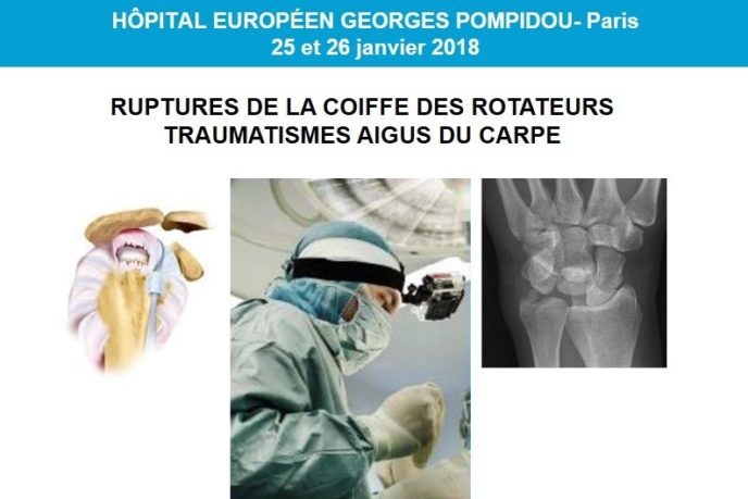 kerimedical congres paris france chirurgie main orthopedie prothese