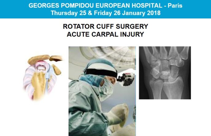 kerimedical congress paris france hand surgery thumb rhizarthrosis prosthesis