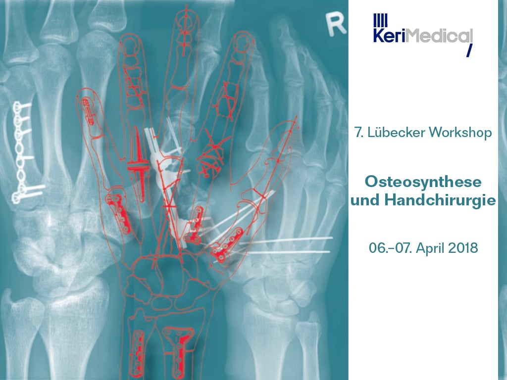Handchirurgische Osteosynthese Workshop Daumensattelgelenk prothese Duo-Mobiler Pfanne
