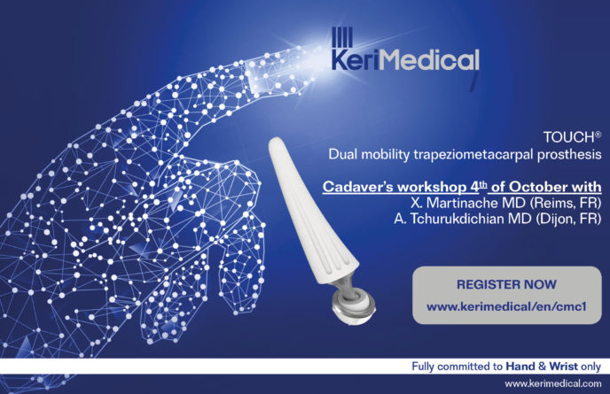 registration cmc1 congress touch dual mobility trapeziometacarpal prosthesis cmc