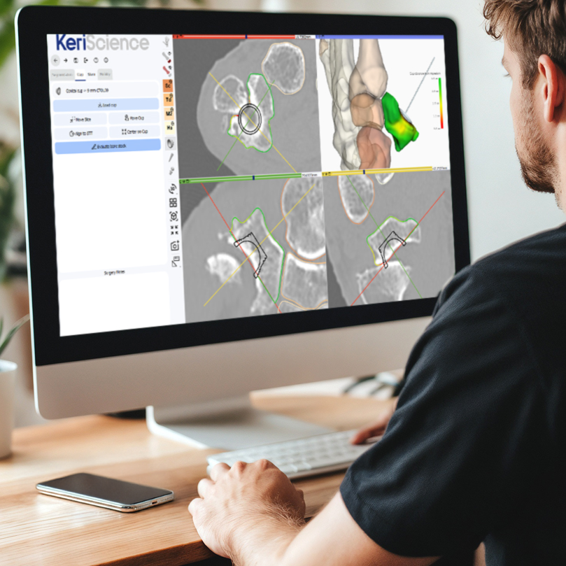 3d planning 