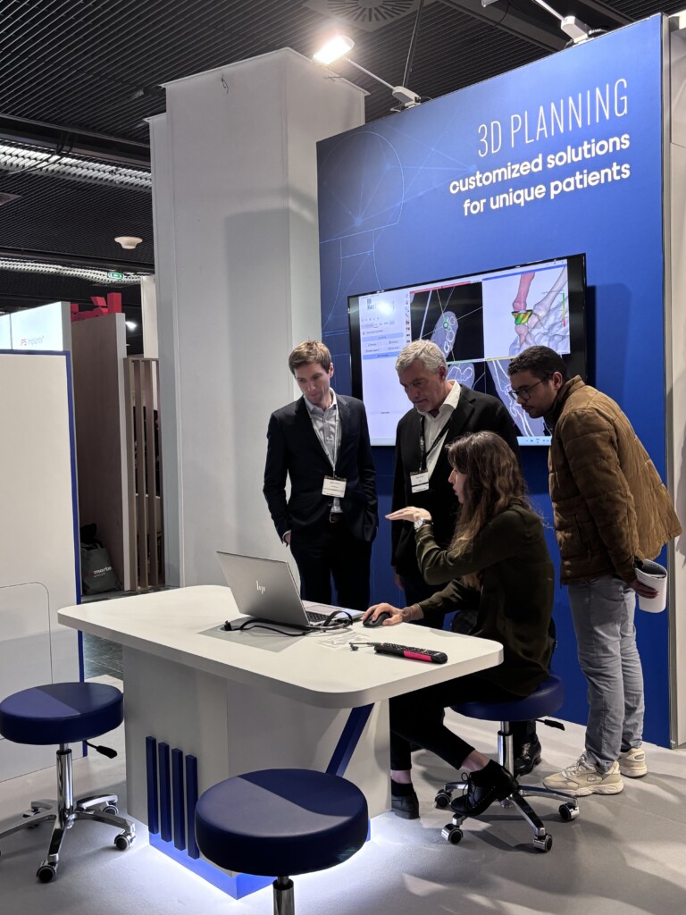 alt="Démonstration de planification 3D pour la chirurgie de la main"