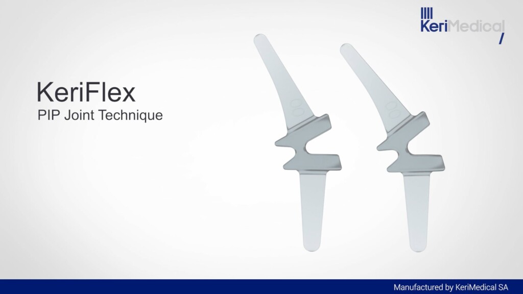 KeriFlex PIP - Surgical Technique